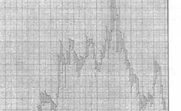 沽权证投资策略与蝶式权证投资策略