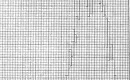 股息降低正是买进的好时机