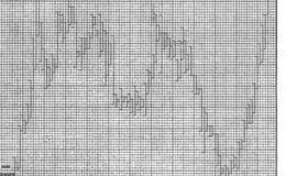 1921年的高价位案例