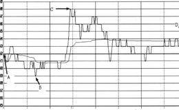 如何看懂走势区？