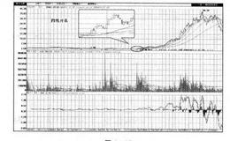 四线牵出大牛股是什么？