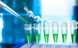 新冠肺炎疫情蔓延全球,诊断试剂题材概念股可关注