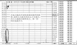 <em>涨停板选股</em>法：当天如何把握涨停板
